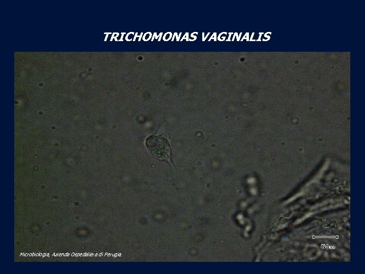 TRICHOMONAS VAGINALIS Microbiologia, Azienda Ospedaliera di Perugia 