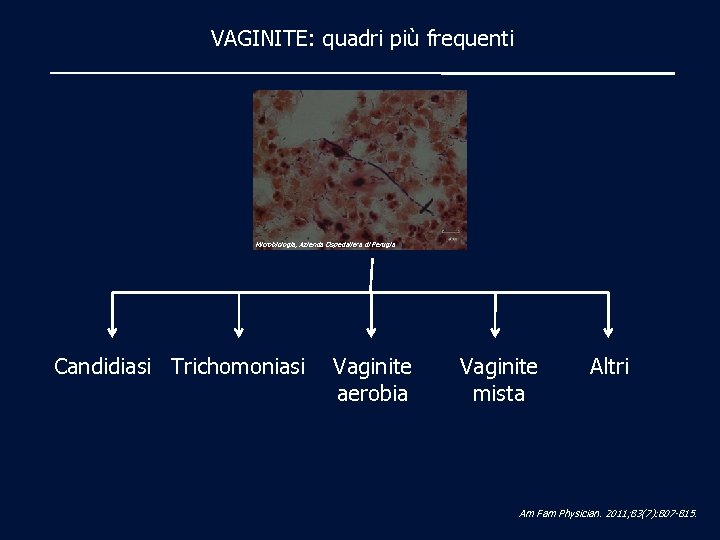VAGINITE: quadri più frequenti Microbiologia, Azienda Ospedaliera di Perugia Candidiasi Trichomoniasi Vaginite aerobia Vaginite