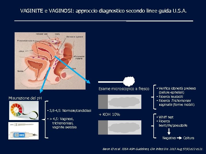 VAGINITE e VAGINOSI: approccio diagnostico secondo linee guida U. S. A. Esame microscopico a