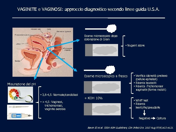 VAGINITE e VAGINOSI: approccio diagnostico secondo linee guida U. S. A. Esame microscopico dopo