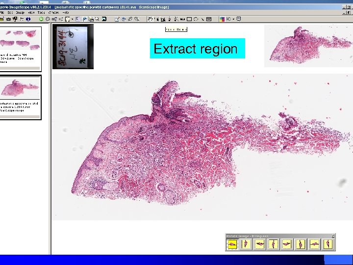 Extract region 