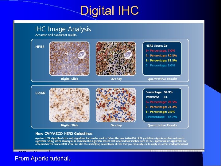 Digital IHC From Aperio tutorial, 