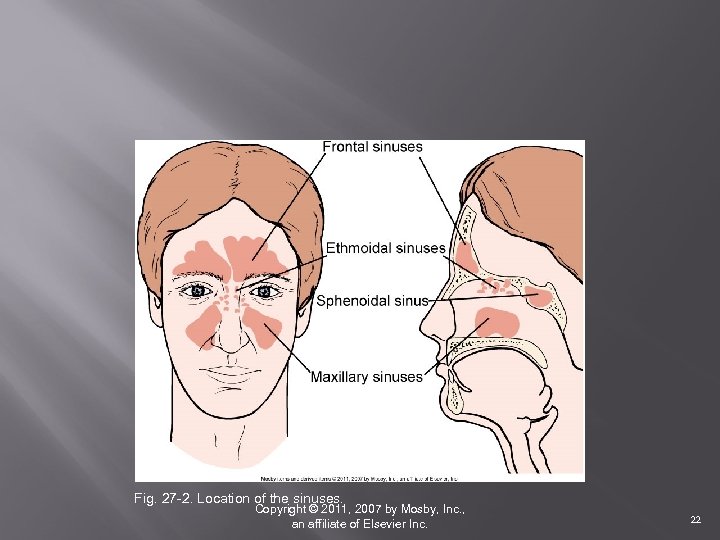SINUSITIS Fig. 27 -2. Location of the sinuses. Copyright © 2011, 2007 by Mosby,