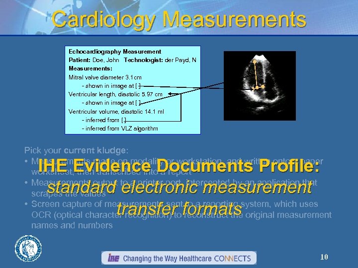 Cardiology Measurements Echocardiography Measurement Patient: Doe, John Technologist: der Payd, N Measurements: Mitral valve
