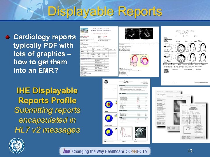 Displayable Reports Cardiology reports typically PDF with lots of graphics – how to get