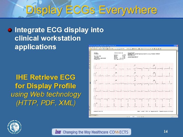 Display ECGs Everywhere Integrate ECG display into clinical workstation applications IHE Retrieve ECG for