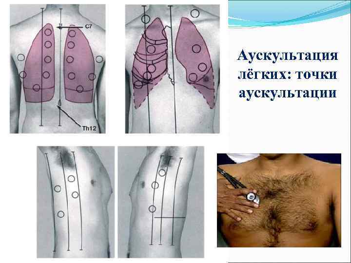 Схема аускультации легких