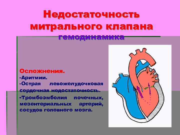 Недостаточность митрального клапана гемодинамика Осложнения. -Аритмии. -Острая левожелудочковая сердечная недостаточность. -Тромбоэмболия почечных, мезентериальных артерий,