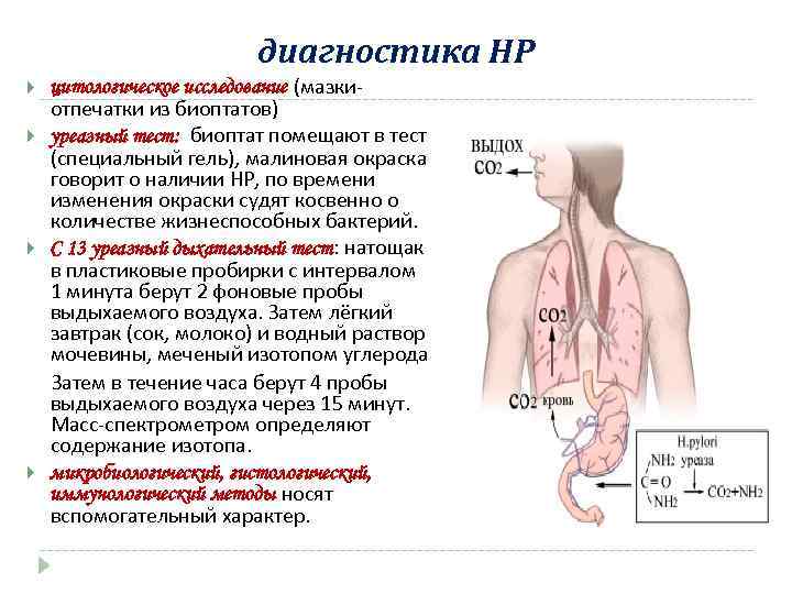диагностика НР цитологическое исследование (мазкиотпечатки из биоптатов) уреазный тест: биоптат помещают в тест (специальный