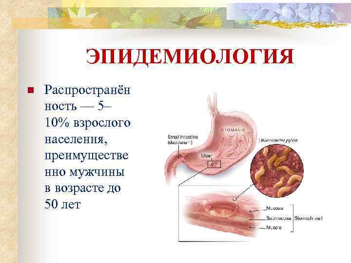 ЭПИДЕМИОЛОГИЯ n Распространён ность — 5– 10% взрослого населения, преимуществе нно мужчины в возрасте
