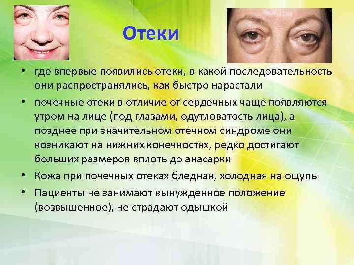 Отеки • где впервые появились отеки, в какой последовательность они распространялись, как быстро нарастали