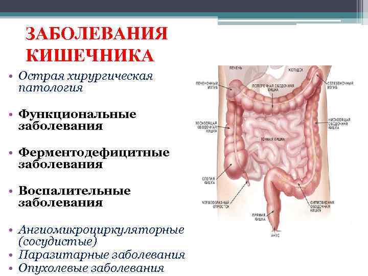 ЗАБОЛЕВАНИЯ КИШЕЧНИКА • Острая хирургическая патология • Функциональные заболевания • Ферментодефицитные заболевания • Воспалительные