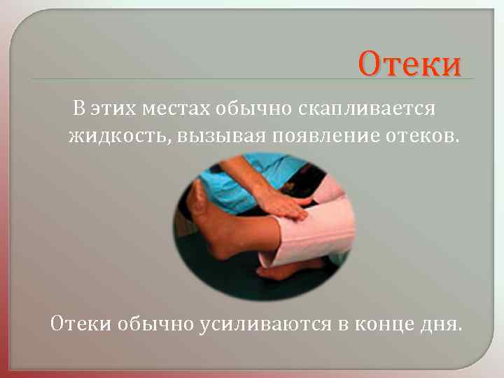 Отеки В этих местах обычно скапливается жидкость, вызывая появление отеков. Отеки обычно усиливаются в