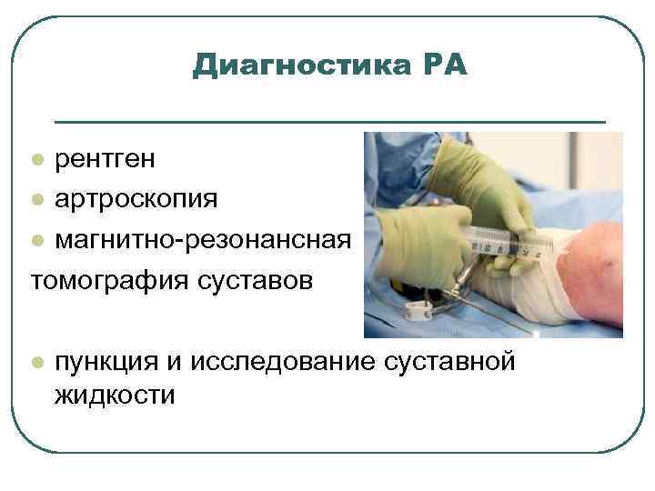 Диагностика РА рентген l артроскопия l магнитно-резонансная томография суставов l l пункция и исследование