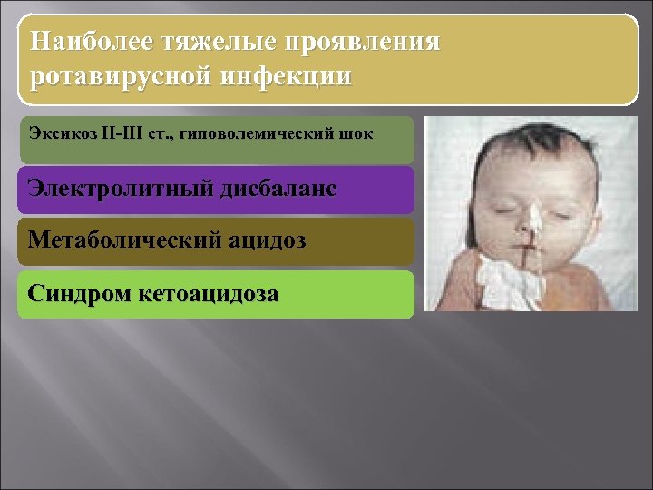 Наиболее тяжелые проявления ротавирусной инфекции Эксикоз II-III ст. , гиповолемический шок Электролитный дисбаланс Метаболический