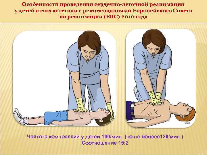 Соотношение компрессий при сердечно легочной реанимации. Базовая сердечно-легочная реанимация у детей. Особенности проведения СЛР У детей. Сердечно-легочная реанимация у детей до 1. Сердечно-лёгочная реанимация у детей до 1 года.