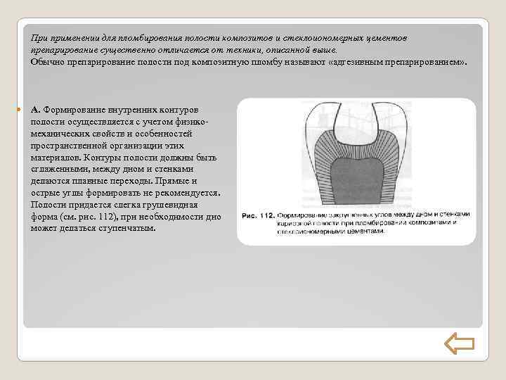 При применении для пломбирования полости композитов и стеклоиономерных цементов препарирование существенно отличается от техники,