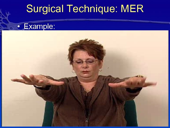 Surgical Technique: MER • Example: 