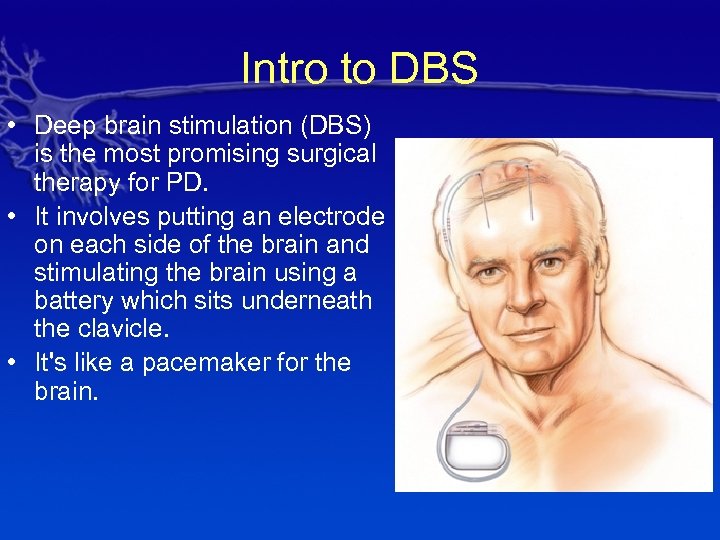 Intro to DBS • Deep brain stimulation (DBS) is the most promising surgical therapy