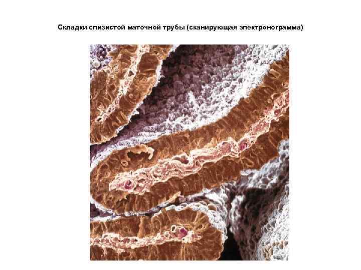 Складки слизистой маточной трубы (сканирующая электронограмма) 