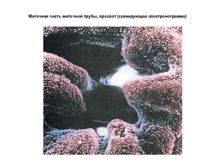 Маточная часть маточной трубы, просвет (сканирующая электронограмма) 