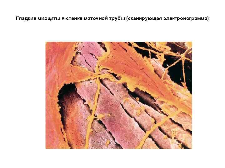 Гладкие миоциты в стенке маточной трубы (сканирующая электронограмма) 