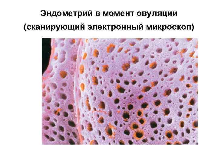 Эндометрий в момент овуляции (сканирующий электронный микроскоп) 