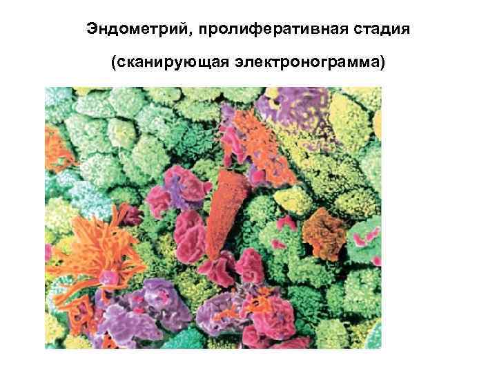 Эндометрий, пролиферативная стадия (сканирующая электронограмма) 