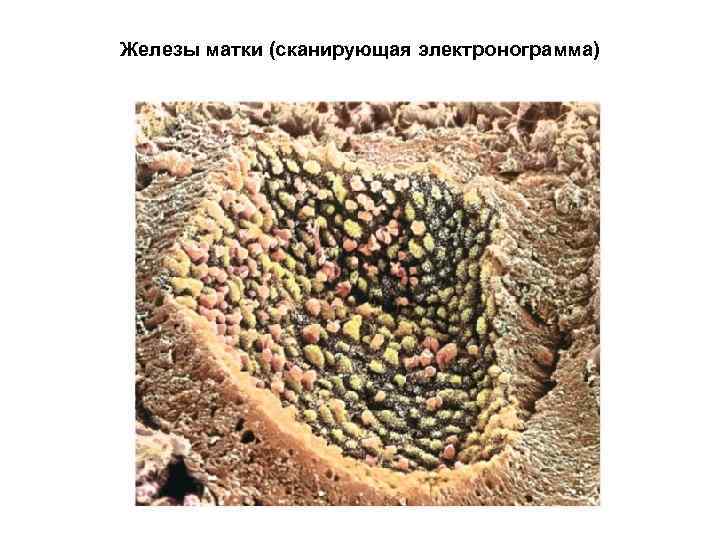 Железы матки (сканирующая электронограмма) 