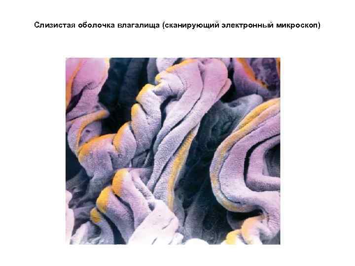 Слизистая оболочка влагалища (сканирующий электронный микроскоп) 