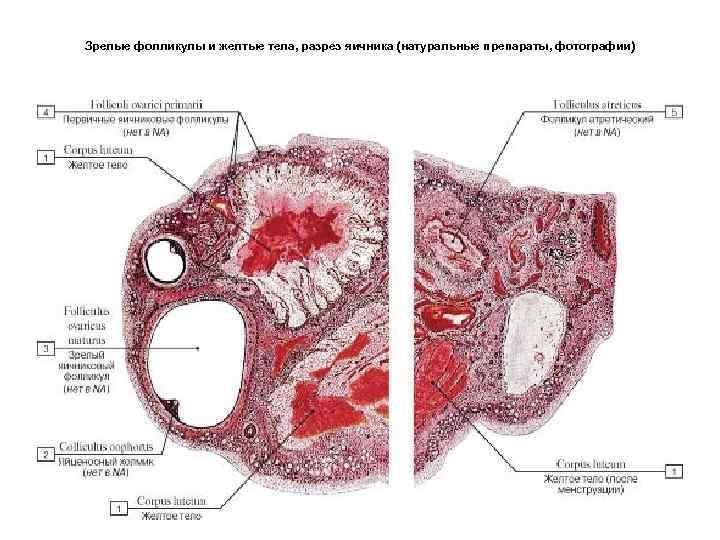 Зрелые фолликулы и желтые тела, разрез яичника (натуральные препараты, фотографии) 