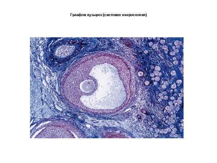 Граафов пузырек (световая микроскопия) 