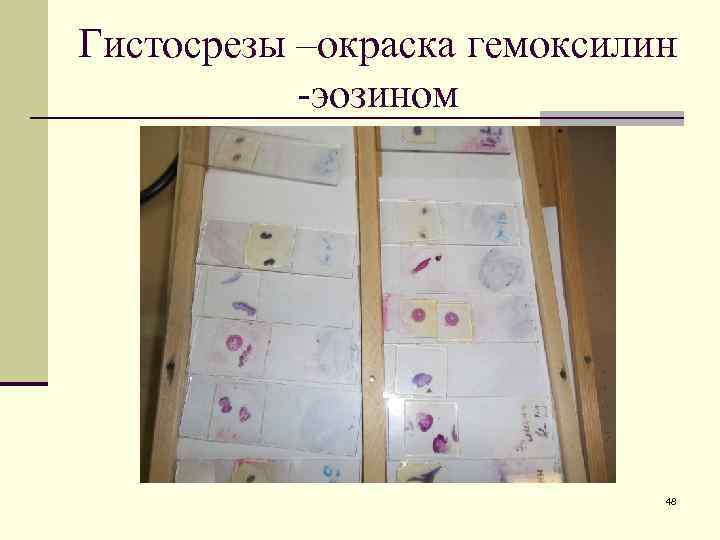 Гистосрезы –окраска гемоксилин -эозином 48 