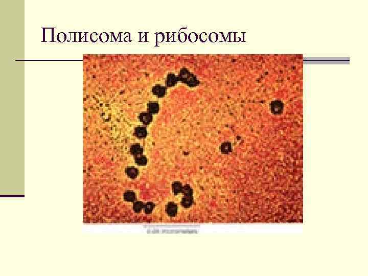 Полисома и рибосомы 