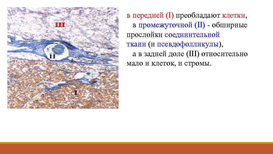 в передней (I) преобладают клетки, в промежуточной (II) - обширные прослойки соединительной ткани (и