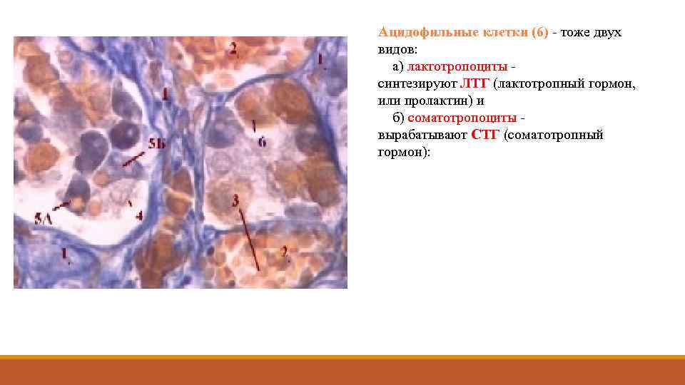 Ацидофильные клетки (6) - тоже двух видов: а) лактотропоциты - синтезируют ЛТГ (лактотропный гормон,