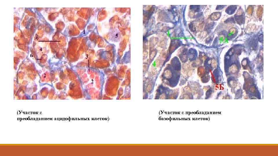 (Участок с преобладанием ацидофильных клеток) (Участок с преобладанием базофильных клеток) 