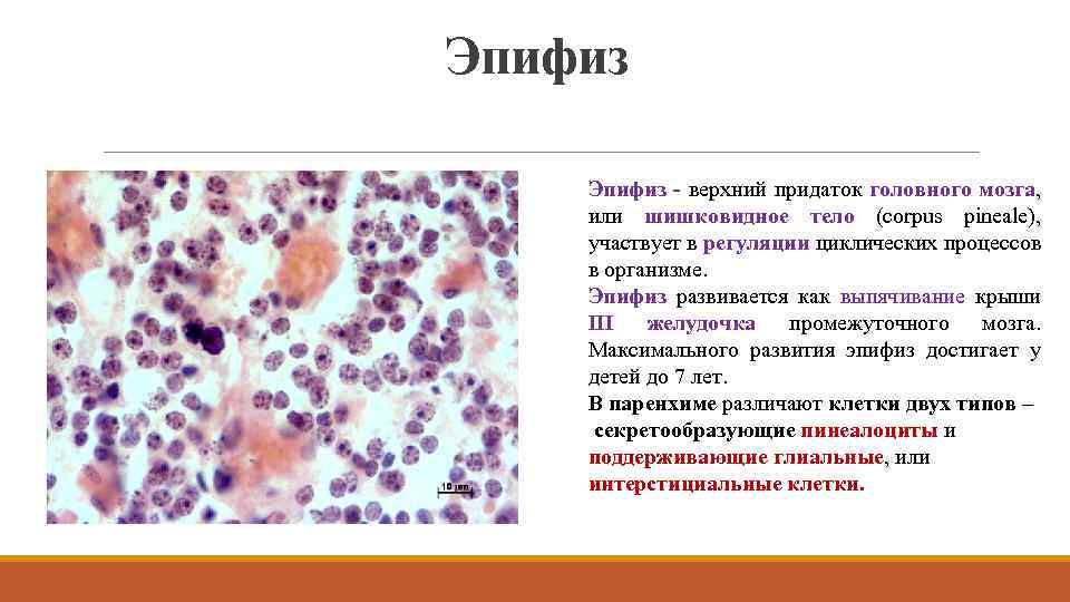 Эпифиз - верхний придаток головного мозга, или шишковидное тело (corpus pineale), участвует в регуляции