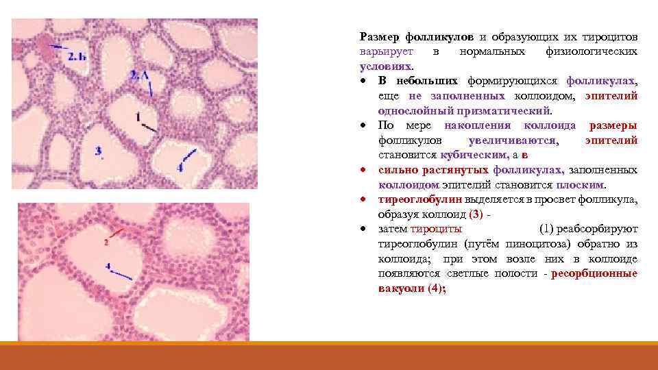 Размер фолликулов и образующих их тироцитов варьирует в нормальных физиологических условиях. В небольших формирующихся