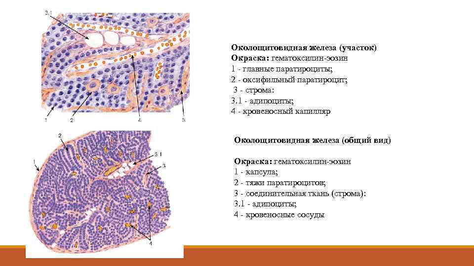 Околощитовидная железа (участок) Окраска: гематоксилин-эозин 1 - главные паратироциты; 2 - оксифильный паратироцит; 3
