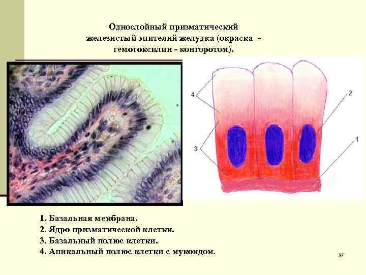 Однослойный призматический железистый эпителий желудка (окраска - гемотоксилин - конгоротом). 1. Базальная мембрана. 2.