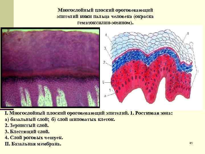 Многослойный плоский ороговевающий эпителий кожи пальца человека (окраска гематоксилин-эозином). I. Многослойный плоский ороговевающий эпителий.