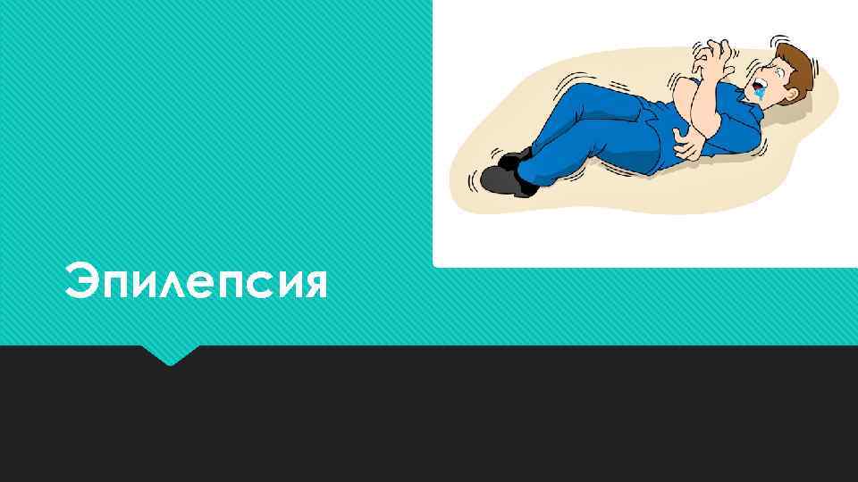 Эпилепсия 