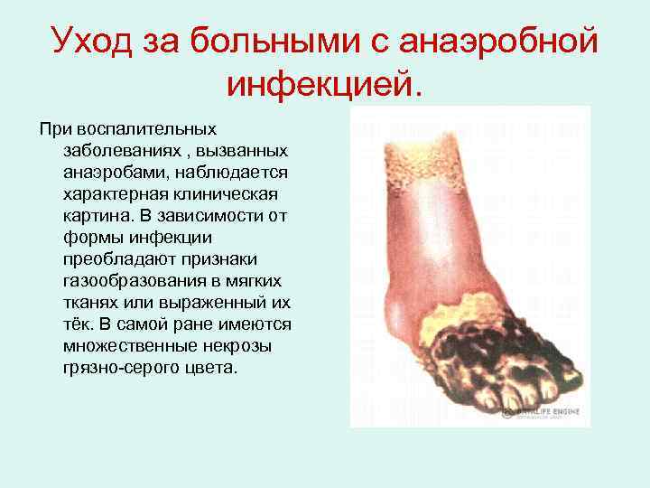 Уход за больными с анаэробной инфекцией. При воспалительных заболеваниях , вызванных анаэробами, наблюдается характерная
