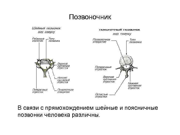 Позвоночник В связи с прямохождением шейные и поясничные позвонки человека различны. 