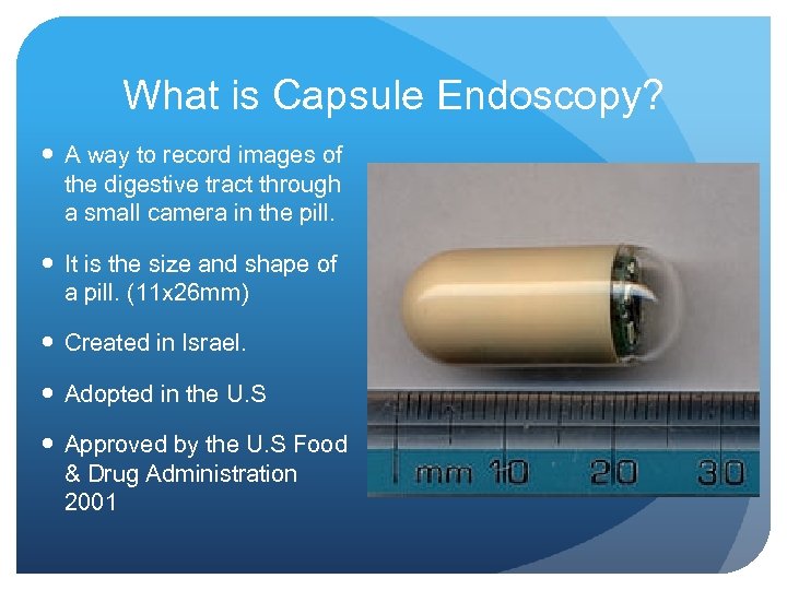 What is Capsule Endoscopy? A way to record images of the digestive tract through