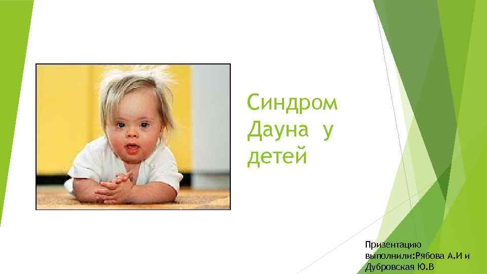 Синдром Дауна у детей Призентацию выполнили: Рябова А. И и Дубровская Ю. В 