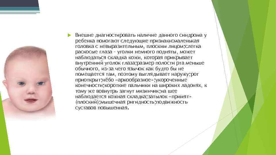  Внешне диагностировать наличие данного синдрома у ребенка помогают следующие признаки: маленькая головка с