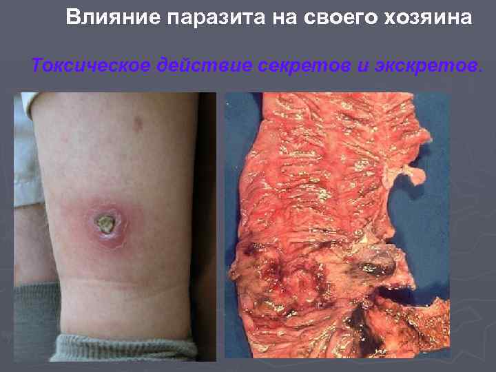Влияние паразита на своего хозяина Токсическое действие секретов и экскретов. 