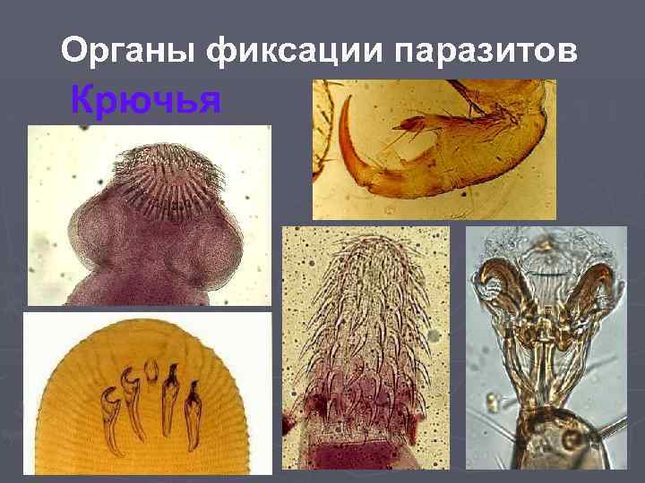 Органы фиксации паразитов Крючья 